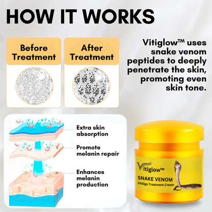 Vitiglow™ Snake Venom Vitiligo Treatment Cream